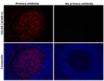 CD106 (VCAM-1) Antibody in Immunohistochemistry (Paraffin) (IHC (P))