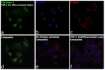 TGF beta-1 Antibody