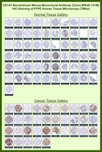 Thrombomodulin/CD141 (Endothelial Cell Marker) Recombinant Mouse Monoclonal Antibody (MSVA-141M)