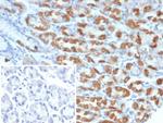 Thrombospondin-1/THBS1 Monoclonal Antibody (THBS1/4532)