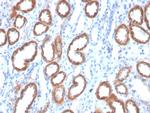 Thrombospondin-1/THBS1 Monoclonal Antibody (THBS1/4532)