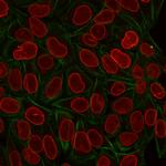 TIA1 (T-Cell-Restricted Intracellular Antigen-1) Monoclonal Antibody (TIA1/1313)