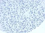 TIA1 (T-Cell-Restricted Intracellular Antigen-1) Recombinant Rabbit Monoclonal Antibody (TIA1/1352R)