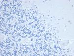 TIMP1 (Marker of Lymph Node Metastasis) Monoclonal Antibody (TIMP1/4358)