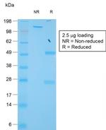 TIMP1 (Colorectal and Lymph Node Metastasis Marker) Recombinant Rabbit Monoclonal Antibody (TIMP1/1944R)