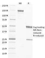 TIMP2 (Tissue Inhibitor of Metalloproteinase 2) Antibody in SDS-PAGE (SDS-PAGE)