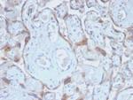 TIMP2 (Tissue Inhibitor of Metalloproteinase 2) Recombinant Rabbit Monoclonal Antibody (TIMP2/2488R)