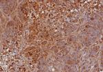 TIMP2 (Tissue Inhibitor of Metalloproteinase 2) Antibody in Immunohistochemistry (Paraffin) (IHC (P))