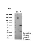 TTF-1/NKX2.1 (Thyroid and Lung Epithelial Marker) Antibody in SDS-PAGE (SDS-PAGE)