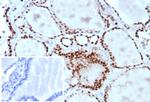 TTF-1/NKX2.1 (Thyroid and Lung Epithelial Marker) Antibody in Immunohistochemistry (Paraffin) (IHC (P))