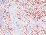 TTF-1/NKX2.1 (Thyroid and Lung Epithelial Marker) Monoclonal Antibody (SPM150)