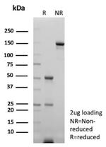 TTF-1/NKX2.1 (Thyroid and Lung Epithelial Marker) Antibody in SDS-PAGE (SDS-PAGE)