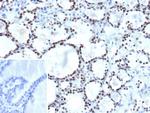TTF-1/NKX2.1 (Thyroid and Lung Epithelial Marker) Antibody in Immunohistochemistry (Paraffin) (IHC (P))
