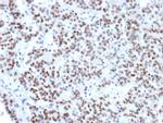 TTF-1/NKX2.1 (Thyroid and Lung Epithelial Marker) Monoclonal Antibody (NX2.1/9033)
