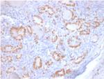 TTF-1/NKX2.1 Recombinant Mouse Monoclonal Antibody (rNX2.1, 690)