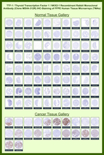 TTF-1/NKX2.1 (Thyroid & Lung Epithelial Marker) Recombinant Rabbit Monoclonal Antibody (MSVA-312R)