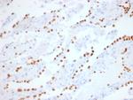 TTF-1/NKX2.1 Recombinant Rabbit Monoclonal Antibody (NX2.1, 1855R)