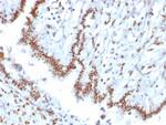 TLE1 (Synovial Sarcoma Marker) Monoclonal Antibody (TLE1/2085)