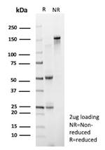 TLE1 (Synovial Sarcoma Marker) Antibody in SDS-PAGE (SDS-PAGE)
