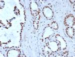 TLE1 (Synovial Sarcoma Marker) Recombinant Rabbit Monoclonal Antibody (TLE1/8007R)