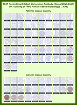 TLE1 (Synovial Sarcoma Marker) Recombinant Rabbit Monoclonal Antibody (MSVA-856R)
