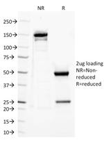 CD282 (Toll-Like Receptor 2) Monoclonal Antibody (TLR2/221)