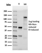 CD282 (Toll-Like Receptor 2) Recombinant Rabbit Monoclonal Antibody (TLR2/3894R)