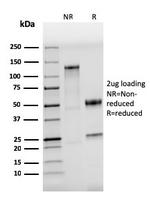 CD284 (Toll-Like Receptor 4) Recombinant Rabbit Monoclonal Antibody (TLR4/3895R)
