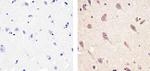 CXCL5 Antibody in Immunohistochemistry (Paraffin) (IHC (P))