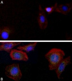 LC3B Recombinant Superclonal™ Antibody