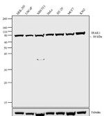 IRAK1 Recombinant Superclonal™ Antibody (19HCLC)