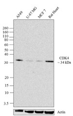CDK4 Antibody in Western Blot (WB)
