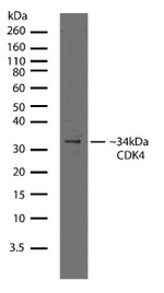 CDK4 Antibody in Western Blot (WB)