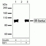 INSR beta Recombinant Superclonal™ Antibody (6HCLC)