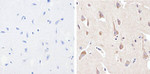 Phospho-PYK2 (Tyr402) Recombinant Superclonal™ Antibody (17HCLC)