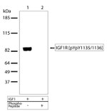 Phospho-IGF1R beta (Tyr1135, Tyr1136) Antibody in Western Blot (WB)