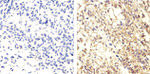 Phospho-EGFR (Tyr1068) Antibody in Immunohistochemistry (Paraffin) (IHC (P))
