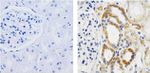 IkB alpha Recombinant Superclonal™ Antibody (6HCLC)