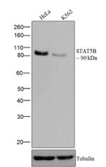 STAT5 beta Recombinant Superclonal™ Antibody (13HCLC)