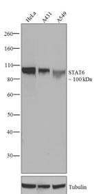 STAT6 Recombinant Superclonal™ Antibody (21HCLC)