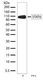 STAT6 Antibody in Western Blot (WB)