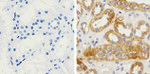 beta Amyloid Recombinant Superclonal™ Antibody (4HCLC)