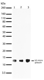 beta-2 Microglobulin Recombinant Superclonal™ Antibody (4HCLC)
