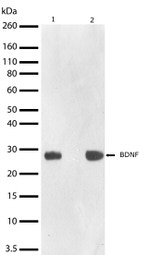 BDNF Recombinant Superclonal™ Antibody (19HCLC)