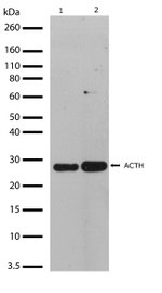 ACTH Antibody in Western Blot (WB)