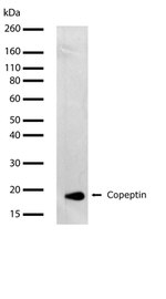 Copeptin Recombinant Superclonal™ Antibody (20HCLC)