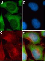 LCN1 Recombinant Superclonal™ Antibody (14HCLC)