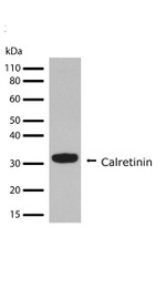 Calretinin Antibody in Western Blot (WB)