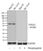 Phospho-FOXA2 (Thr156) Antibody in Western Blot (WB)