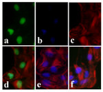 Phospho-FOXA2 (Thr156) Recombinant Superclonal™ Antibody (10HCLC)